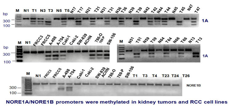 NORE1 methylation analysis